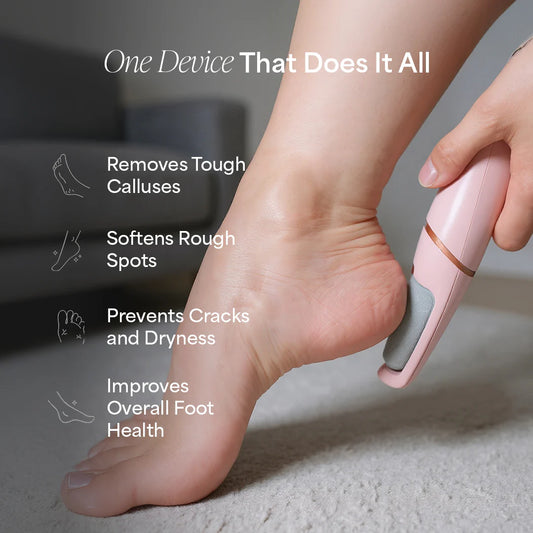 SoleGlow™ Pro Callus Remover
